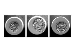 Examples of embryos evaluated by the STORK-A algorithm. From left to right, an embryo predicted to have a normal chromosome count or a single chromosomal abnormality; an embryo predicted to have a normal chromosome count; an embryo predicted to have more than one chromosomal abnormality.