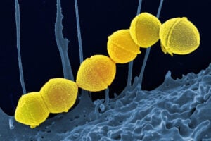 Image of Group A streptococcus bacteria. Credit: National Institute of Allergy and Infectious Diseases, National Institutes of Health