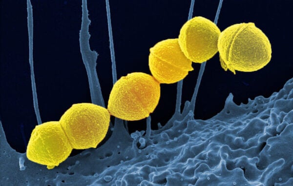 Image of Group A streptococcus bacteria. Credit: National Institute of Allergy and Infectious Diseases, National Institutes of Health
