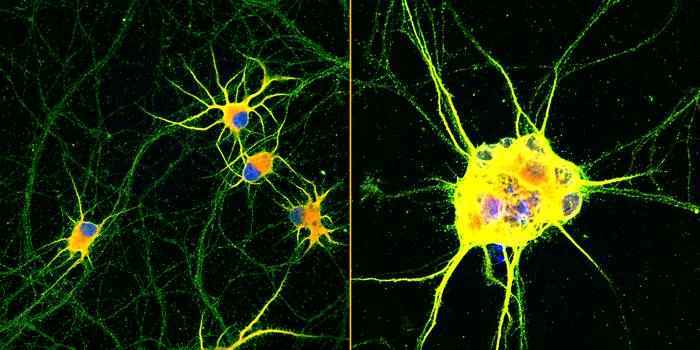 Fluorescent images of human neurons (stained with red, green and blue) growing on coatings with fast-moving molecules (left) or conventional laminin (right) for 60 days. Neurons spread homogenously and showed more complex branching on the highly mobile coating developed at Northwestern.