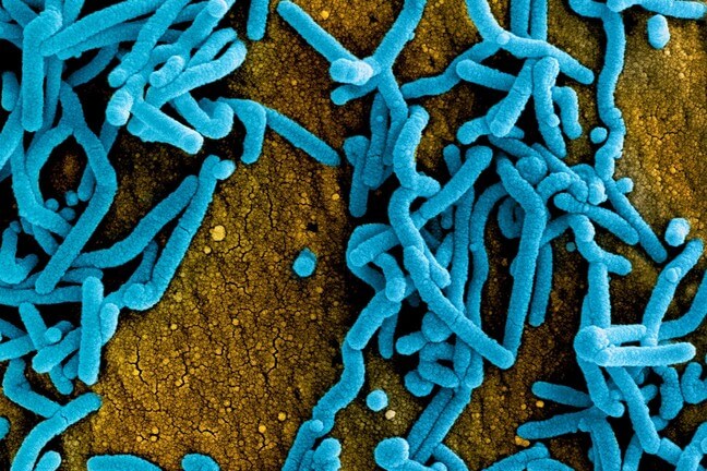 Colorized scanning electron micrograph of Marburg virus particles (blue) both budding and attached to the surface of infected VERO E6 cells (orange).