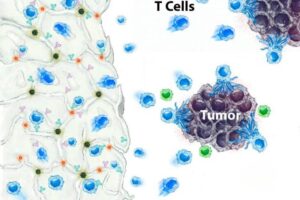 The SymphNode device (left), contains nanoparticles (red dots) that release a drug that blocks the activity of regulatory T cells (green), which suppress the body’s response to solid tumors. At the same time, the SymphNode’s microparticles (black dots) attract and beef up cancer-fighting T cells.