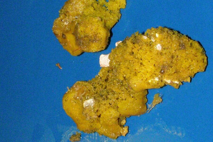 Sea sponges have been found to be a rich source of biochemical compounds with potentially therapeutic properties. Pictured: Lissodendoryx florida, from which lissodendoric acid A was isolated.