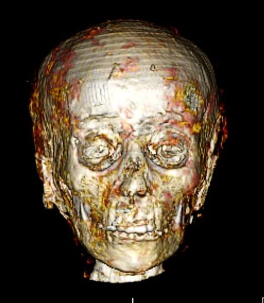 The mummy's face on CT scans.