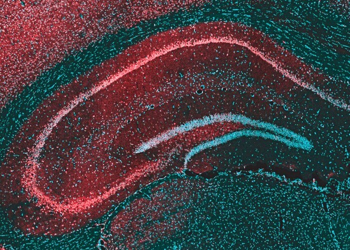 This microscope image of the brain region called the hippocampus shows the protein targeted by cannabis-derived CBD, GPR55 (red), and brain cells (blue) that send their extensions out to form the layers seen in the image. The interconnected nature of the hippocampus makes it a major site of for the initiation and spread of seizures.