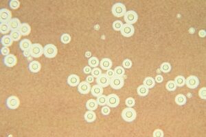 This photomicrograph depicts Cryptococcus neoformans a fungal pathogen that has been causing an increasing number of life-threatening infections. People with AIDS, and those using immunosuppressive drugs are most vulnerable.