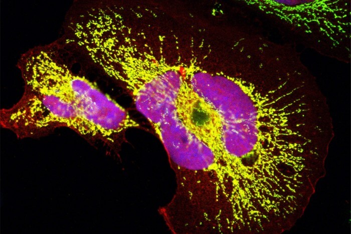 The microprotein in the mitochondria (green) and in the nucleus (blue) was overexpressed in human cells. The yellow and pink areas show that the signal of the microprotein overlaps with the mitochondrial and nuclear signals.