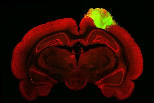 Human brain tissue responds to visual stimuli when transplanted into rats