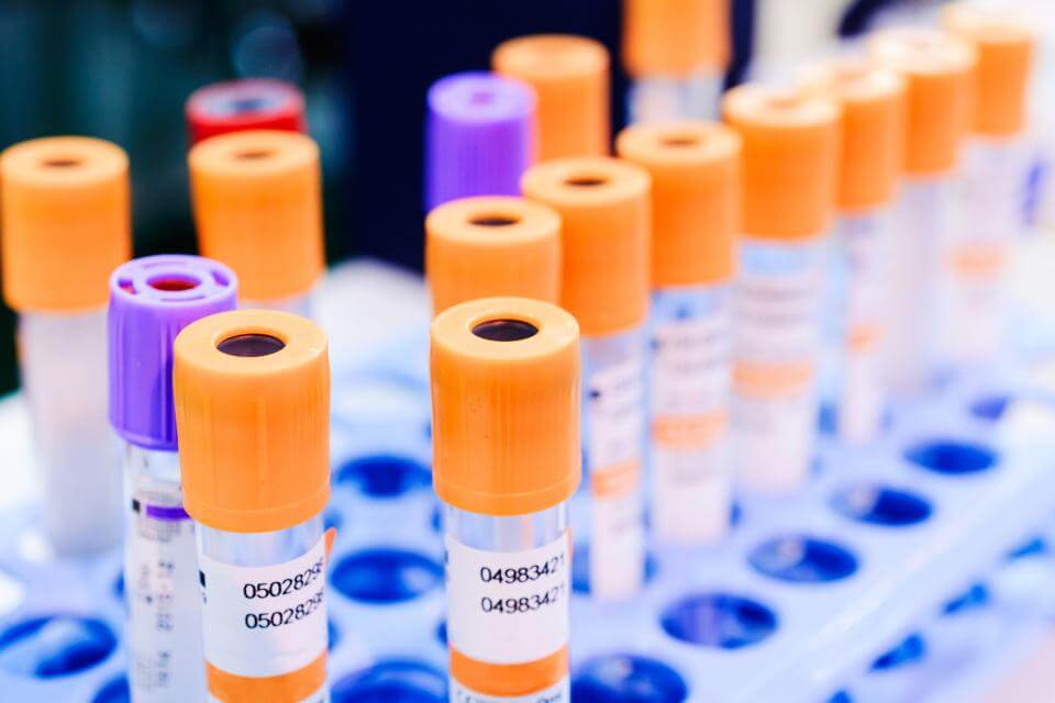 Orange- and purple-capped test tubes.