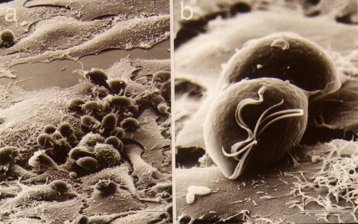 (Left) Scanning electron microscopy image of numerous Trichonomous vaginalis organisms attached to epithelial cells grown in the laboratory. (Right) An enlargement of the microscopy photo showing two organisms grown in the laboratory.