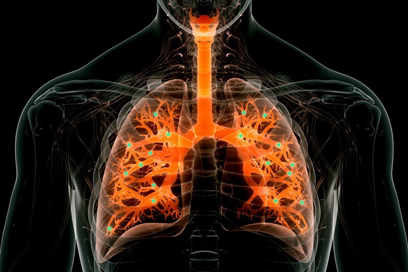 Engineers at MIT and the University of Massachusetts Medical School have designed a new type of nanoparticle that can be administered to the lungs, where it can deliver messenger RNA encoding useful proteins. Credits:Image: iStock, edited by MIT News