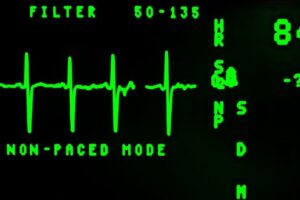 medical monitor readout in green