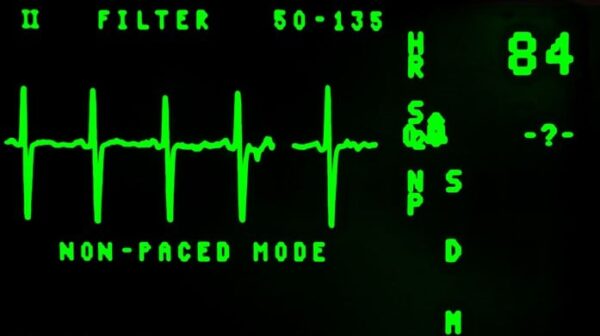 medical monitor readout in green