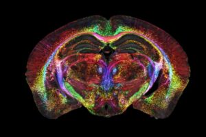 A super-powerful MRI merged with light-sheet microscopy allows researchers to create a high-definition wiring diagram of the entire brain in mice.