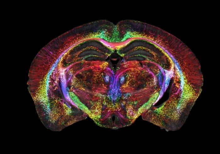 Brain images just got 64 million times sharper