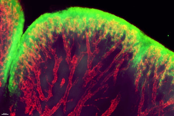 Blood vessels in the soft tissue between joints, during a rheumatoid arthritis flare-up.