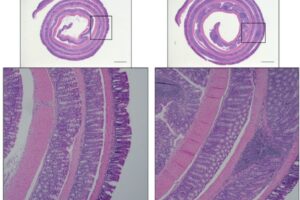 Control mice show the ability to clear away an experimental infection (images in the left column). But mice with impaired antimicrobial programs show increased intestine damage and inflammation (images in the right column), according to a study published in the Journal of Experimental Medicine.