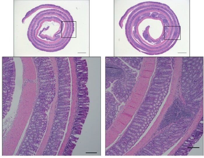 Control mice show the ability to clear away an experimental infection (images in the left column). But mice with impaired antimicrobial programs show increased intestine damage and inflammation (images in the right column), according to a study published in the Journal of Experimental Medicine.