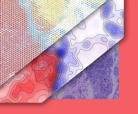 Software IDs Molecular Interactions within Tumors