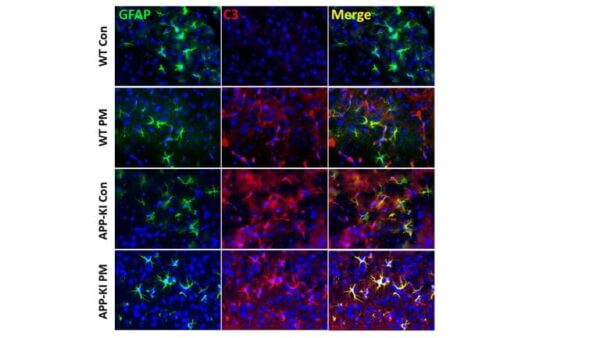 Traffic pollution weakens brain function