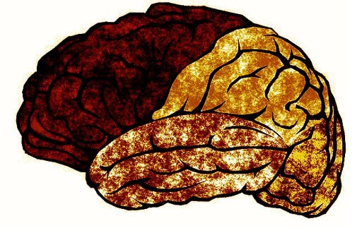 Dying brain illustration Credit Pixabay