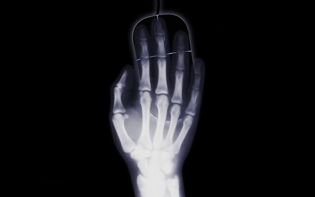 xray of a hand on a pc mouse