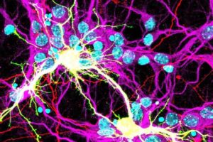 Image of fused neurons (yellow) expressing Spike S fusogen from the SARS-CoV-2 virus and the human receptor hACE2.