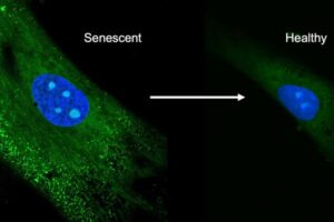 Confocal images of mesenchymal stem cells. The left shows the senescent cells producing unwanted biomolecules, the right shows the cells after treatment with the antioxidant crystals.