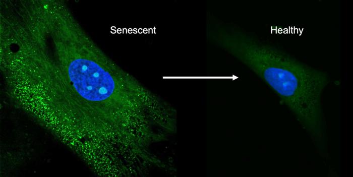 Confocal images of mesenchymal stem cells. The left shows the senescent cells producing unwanted biomolecules, the right shows the cells after treatment with the antioxidant crystals.