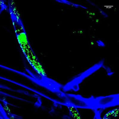 The fluorescence image shows M. rhizoxinica bacteria (green) enclosed in parts of a fungal hyphal (blue).