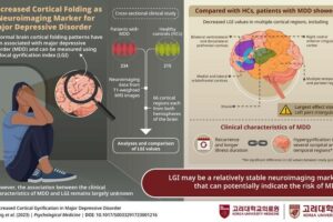 Local gyrification index may be a relatively stable neuroimaging marker for establishing the predisposition to major depressive disorder