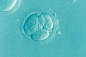 IVF under a microscope. Pixabay