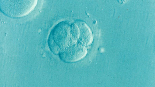 IVF under a microscope. Pixabay