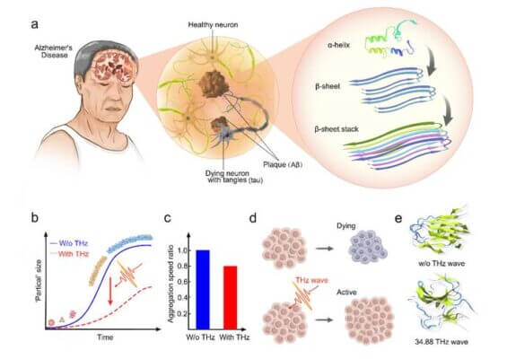 Potential Alzheimer’s treatment would use high-frequency terahertz radiation