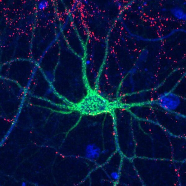 Complex sugar molecules control the formation of perineuronal nets (shown here in green) that surround neurons to help stabilize connections in the brain.