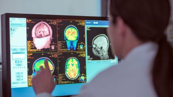 Physician reads a color monitor brain scan. From University of Michigan