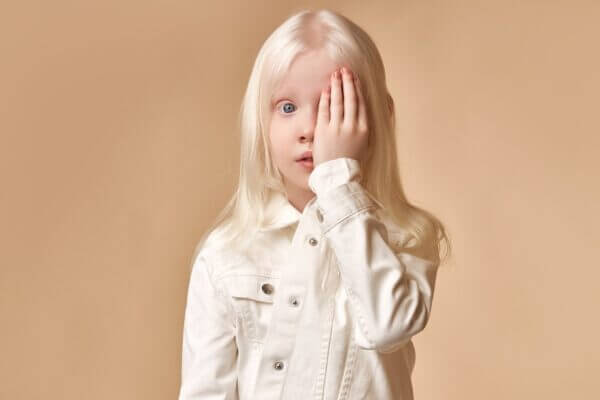 What causes spontaneous eye movements in albinism?