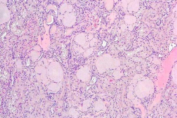 Squirrel kidney c...                    </div>

                    <div class=