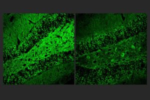 Picower Institute researchers discovered that a molecule called A11 combats inflammation in the brain amid Alzheimer's disease. For example, A11-treated Alzheimer's model mice (right) showed much less tau protein (green staining), a hallmark of disease pathology, than untreated controls (left).