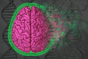 Alzheimer's brain illustration from MIT