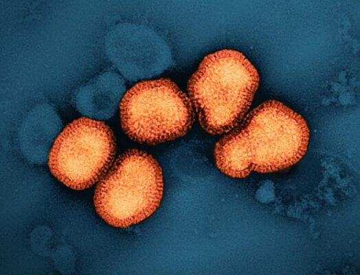 A colorized transmission electron micrograph of influenza A virus particles, colorized orange, isolated from a patient sample and then propagated in cell culture. NIAID