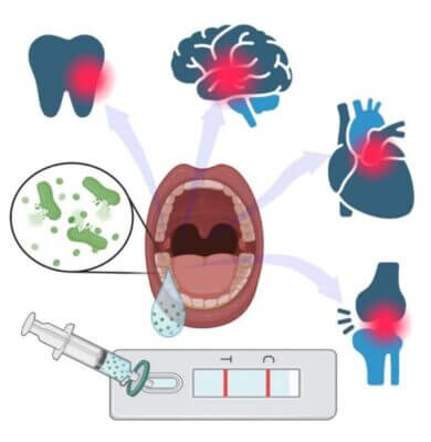 New at-home test for gingivitis protects oral health