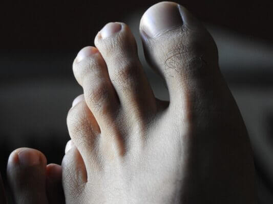 Skin behind the ears and between the toes can host a collection of unhealthy microbes