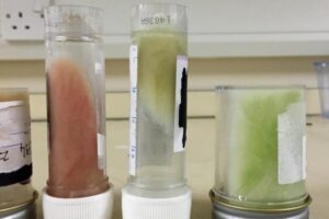 Different coloured sputum used as indicators of the degree of inflammation in the lungs