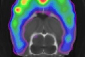 Scan of a rat brain showing the serotonin 5-HT2A receptor affected by psylocobin.