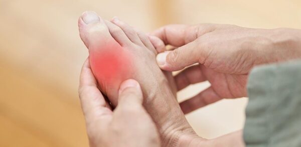 Cancer drug could hold hope for treating inflammatory diseases including gout and heart diseases