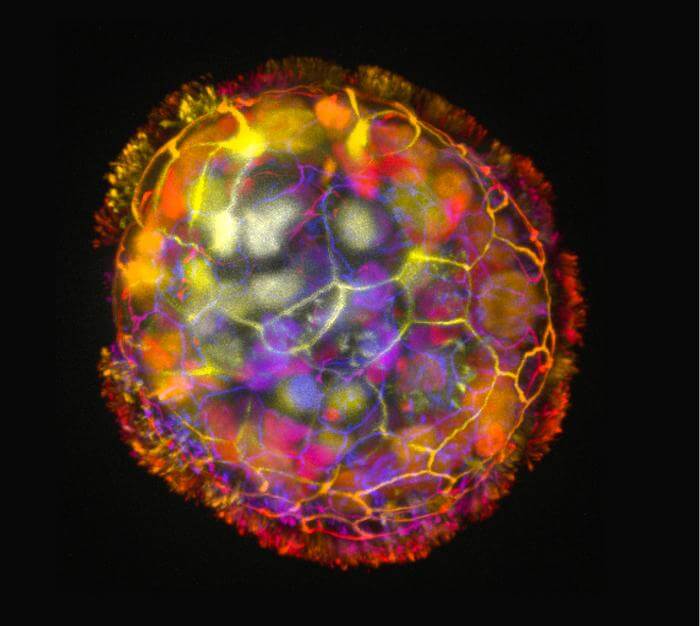 An Anthrobot is shown, depth colored, with a corona of cilia that provides locomotion for the bot