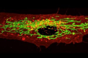 In most cells, mitochondria (green) form complex tubular networks that help them distribute energy throughout the cell. Disruption of these mitochondrial networks is a hallmark of many human diseases. Photo credit: UC San Diego Health Sciences