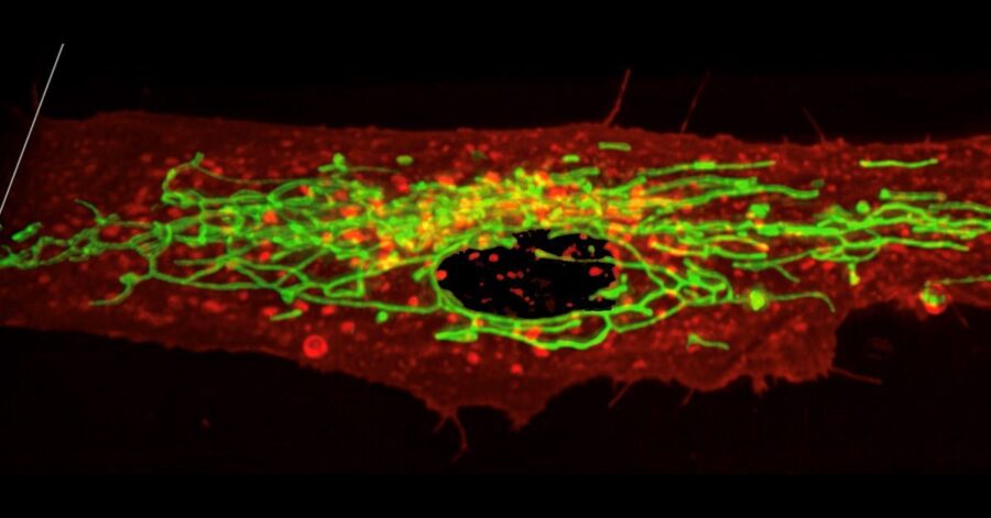 In most cells, mitochondria (green) form complex tubular networks that help them distribute energy throughout the cell. Disruption of these mitochondrial networks is a hallmark of many human diseases. Photo credit: UC San Diego Health Sciences