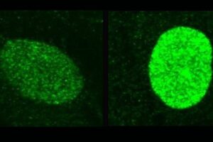 These microscope images show how interferon in the nucleus raises levels of the protective protein IFI16 (stained green) from low background levels (left) to the higher levels needed to resist herpes infection (right). Image: HMS MicRoN core imaging facility/Nicolas Romero Rata